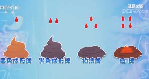 没有喝咖啡，呕吐物却是咖啡色！警惕这是胃出血